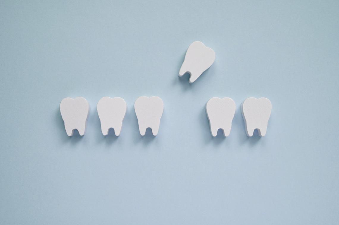 Prothèse dentaire implant