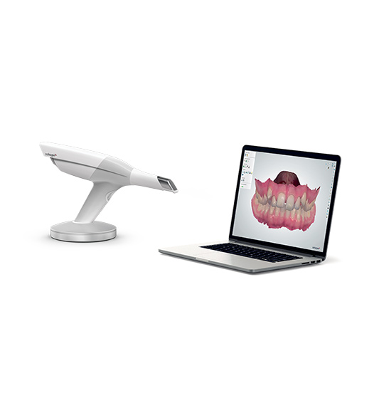 Dentist Brussels Digital impression